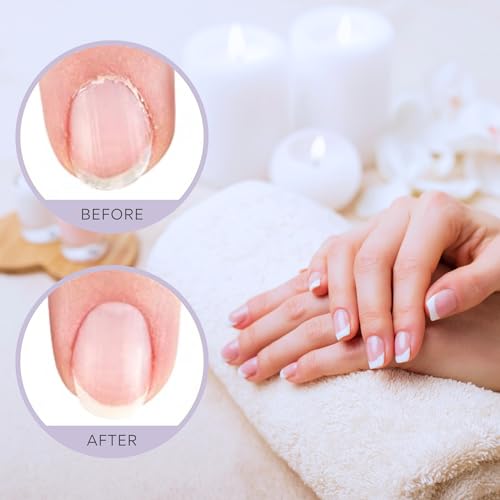 C CARE Sweet Almond Cuticle Oil For Nails - Repairs Cuticles Overnight - Moisturizes and Strengthens Nails and Cuticles - Dropper & Brush included - 2.5oz
