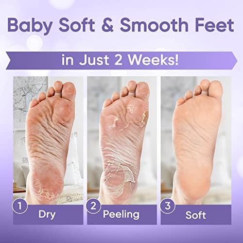 Foot Peel Mask - Foot Mask for Baby Soft Skin - Remove Dead Skin, Dry, Cracked Feet & Callus, Foot Spa, Made with Aloe Vera Extract for Women and Men (2 Pair (Pack of 1), Lavender)