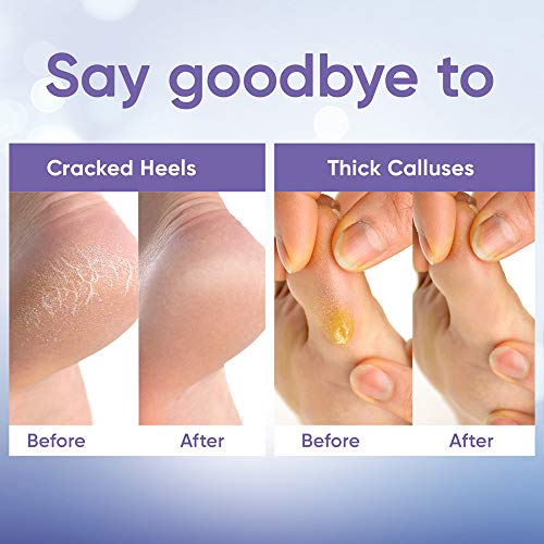 Foot Peel Mask - Foot Mask for Baby Soft Skin - Remove Dead Skin, Dry, Cracked Feet & Callus, Foot Spa, Made with Aloe Vera Extract for Women and Men (2 Pair (Pack of 1), Lavender)