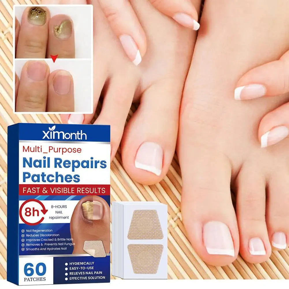 60pcs/Box Toenail Fungus Treatment Stickers Paronychia Removal Treatment Nail Ingrown Correction Stickers Pedicure Tools Care