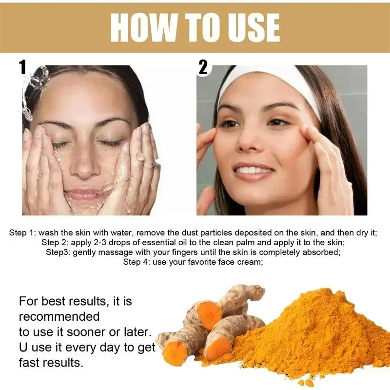 Turmeric Freckle Whitening Serum Curcumin Oil Brighten Removal Pigment Melanin Fade Dark Spot Correcting Beauty Face Skin Care