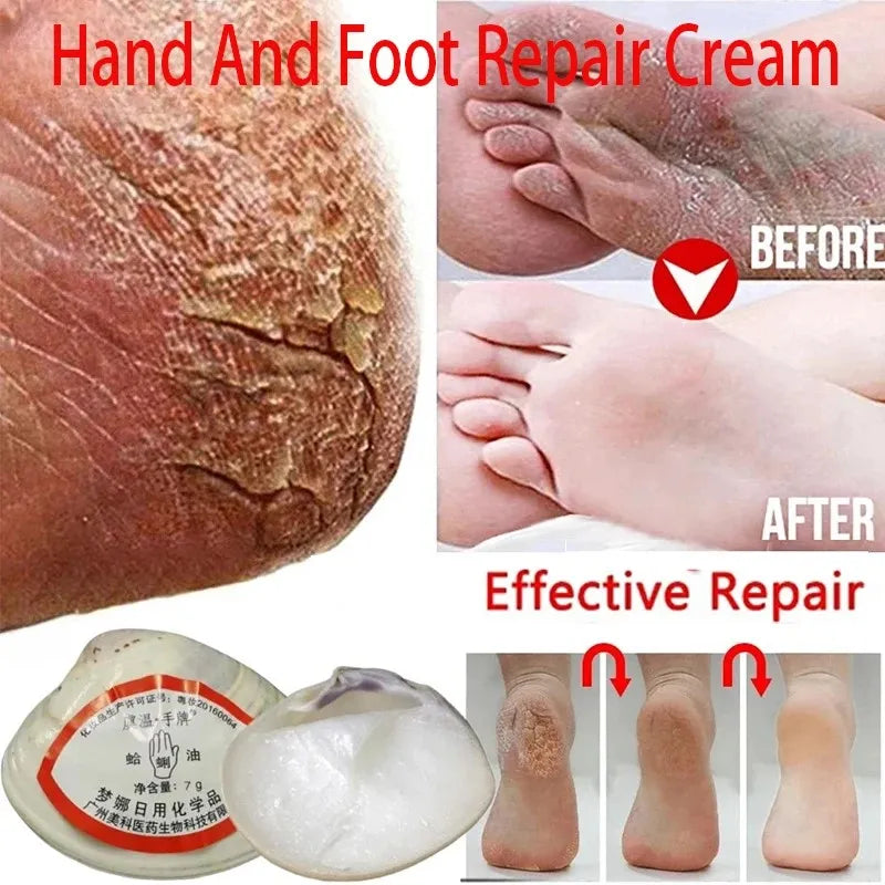 PWYUMAN - New Traditional Chinese Clam Oil Anti-Dry Crack Foot Repair Cream Removal Dead Skin Callus Soften Hand Heel Moisturize Care Mask