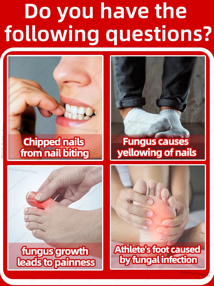 Fungal Nail Repair Fast Onychomycosis Fungus Nails