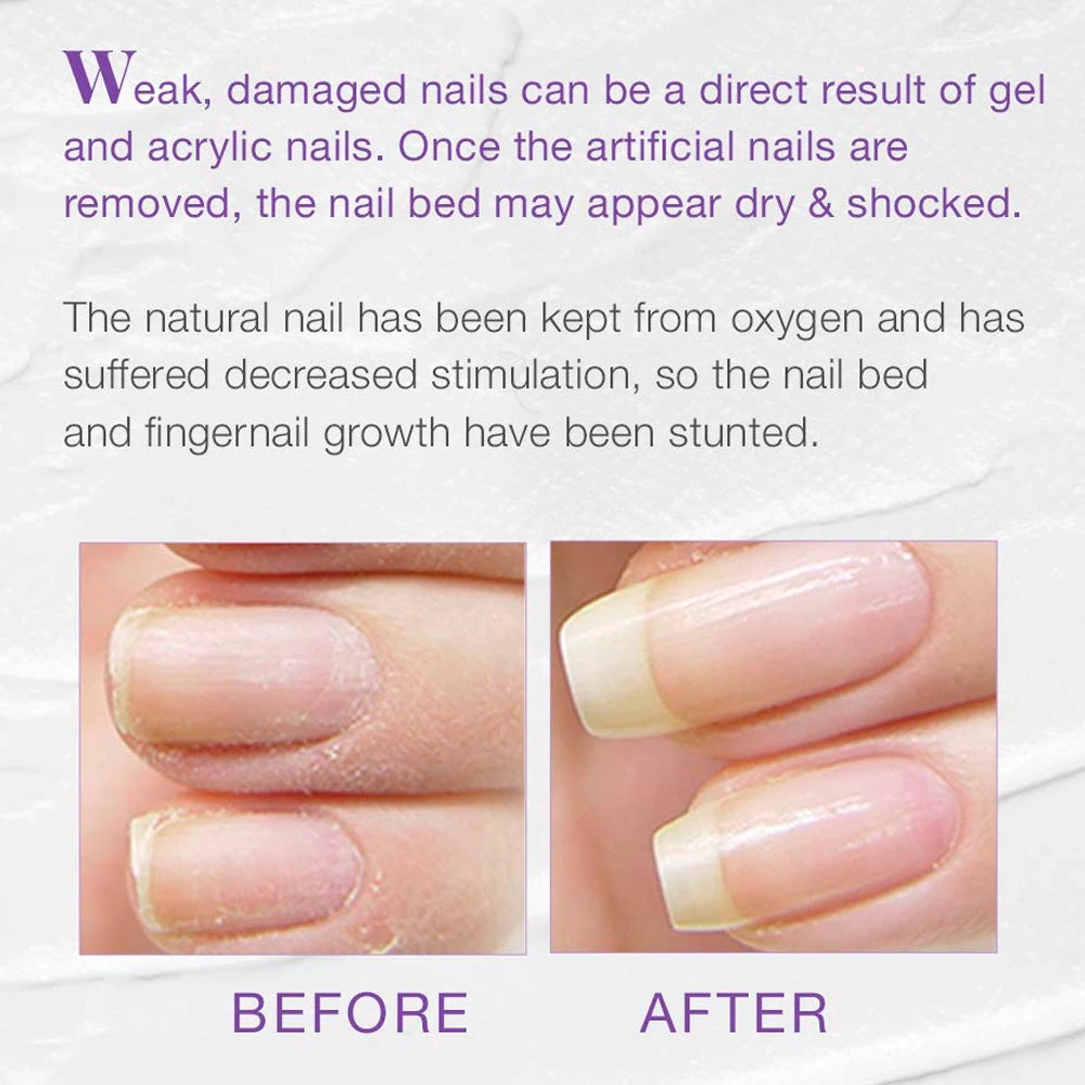 KODIES GEL Keratin Nail Strengthener 12ML Instant Gloss Ultra Hard Nail Hardener Finish Natural Dry Nail Growth Polish Treatment