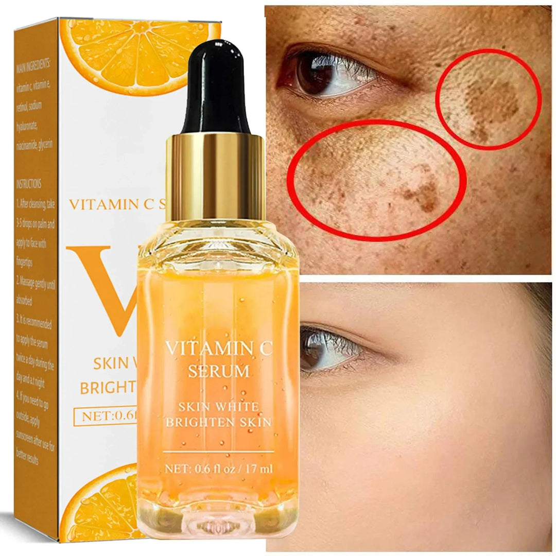 Vitamin C Fade Dark Spots Serum Whitening Freckles Fade Melanin Retinol Anti-wrinkle Essence Brightening Korean Skincare 2024