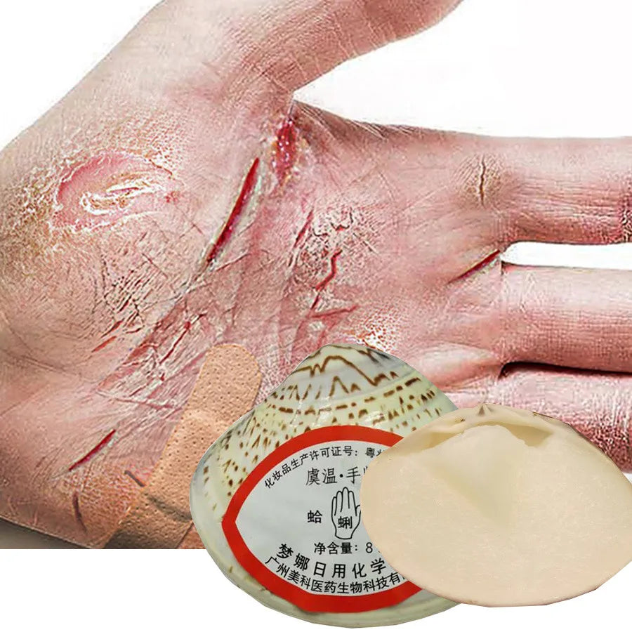 PWYUMAN - New Traditional Chinese Clam Oil Anti-Dry Crack Foot Repair Cream Removal Dead Skin Callus Soften Hand Heel Moisturize Care Mask