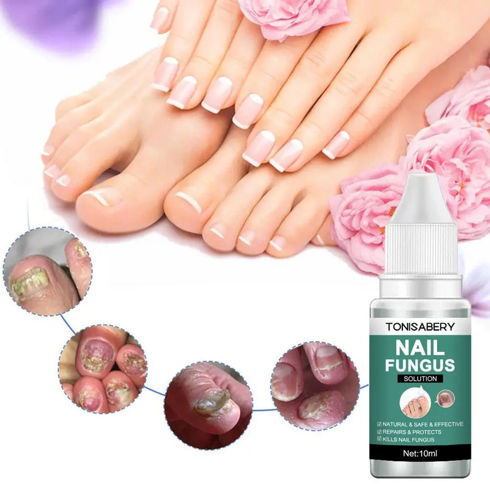 Nail Fungal Treatment Feet Care Essence Anti Infection Onychomycosis Removal Toe Nail Foot Fungus Paronychia Nail Care Body T4X8