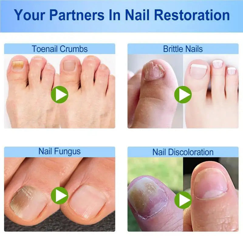 Toenail Patches Nail Repair Extra Strength Patches For Toenail Fingernail Non-Irritating And Breathable Nail Repair Renewal