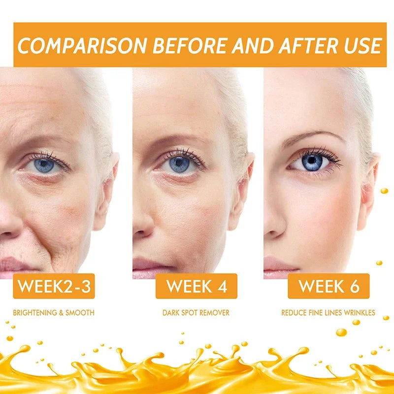 Vitamin C Fade Dark Spots Serum Whitening Freckles Fade Melanin Retinol Anti-wrinkle Essence Brightening Korean Skincare 2024