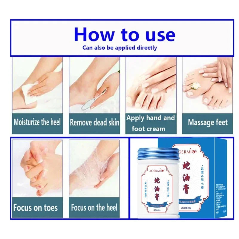 Herbal Anti Crack Foot Cream Heel Cracking Repair Products Exfoliation Dead Skin Removal Softening Moisturize Smooth Skin Care