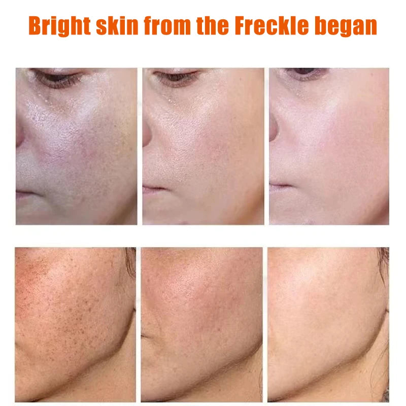 Spot Removing Essence Vitamin C Facial Spray Mist Anti-wrinkle Nourishing Relieve Redness Moisturizing Portable Whitening