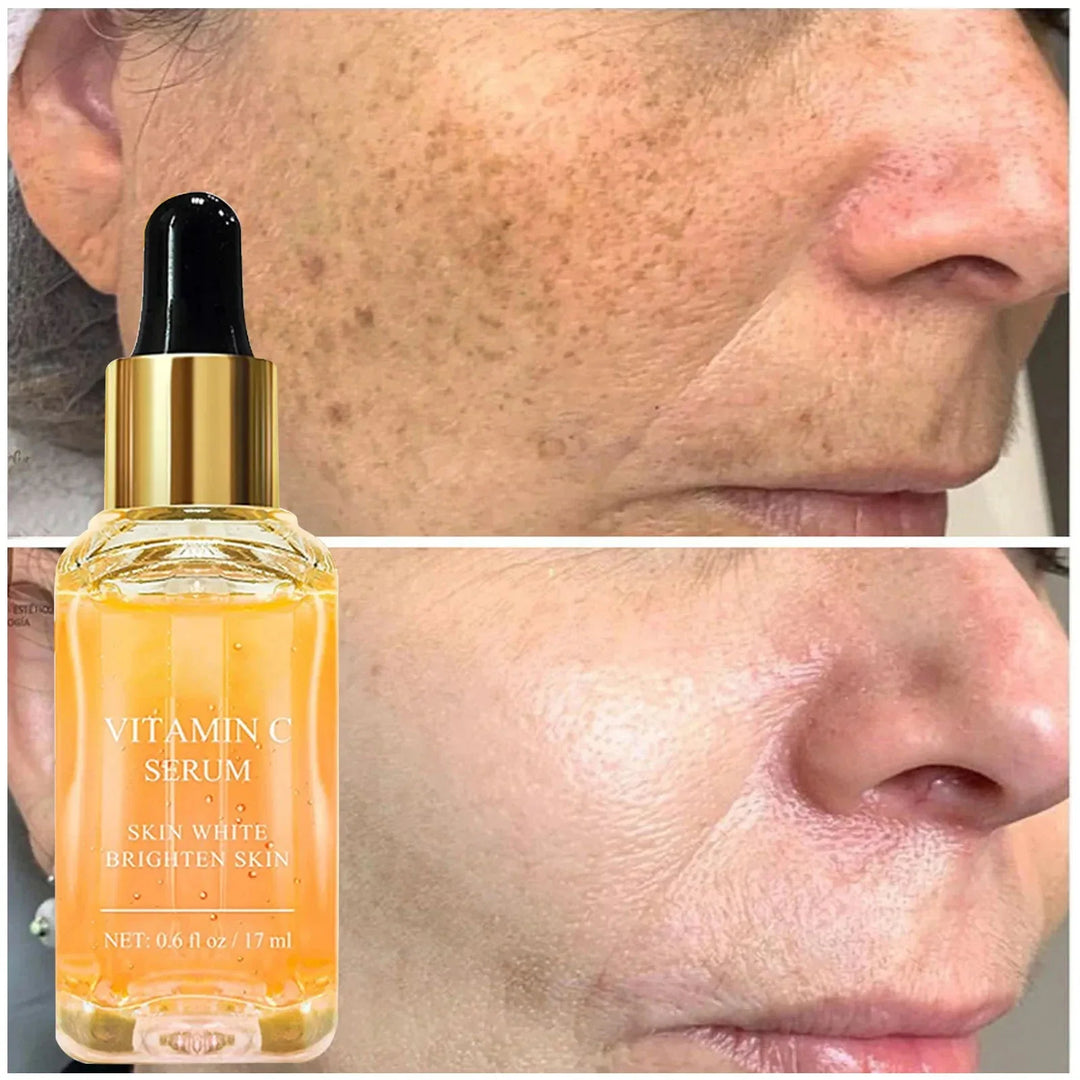 Vitamin C Fade Dark Spots Serum Whitening Freckles Fade Melanin Retinol Anti-wrinkle Essence Brightening Korean Skincare 2024