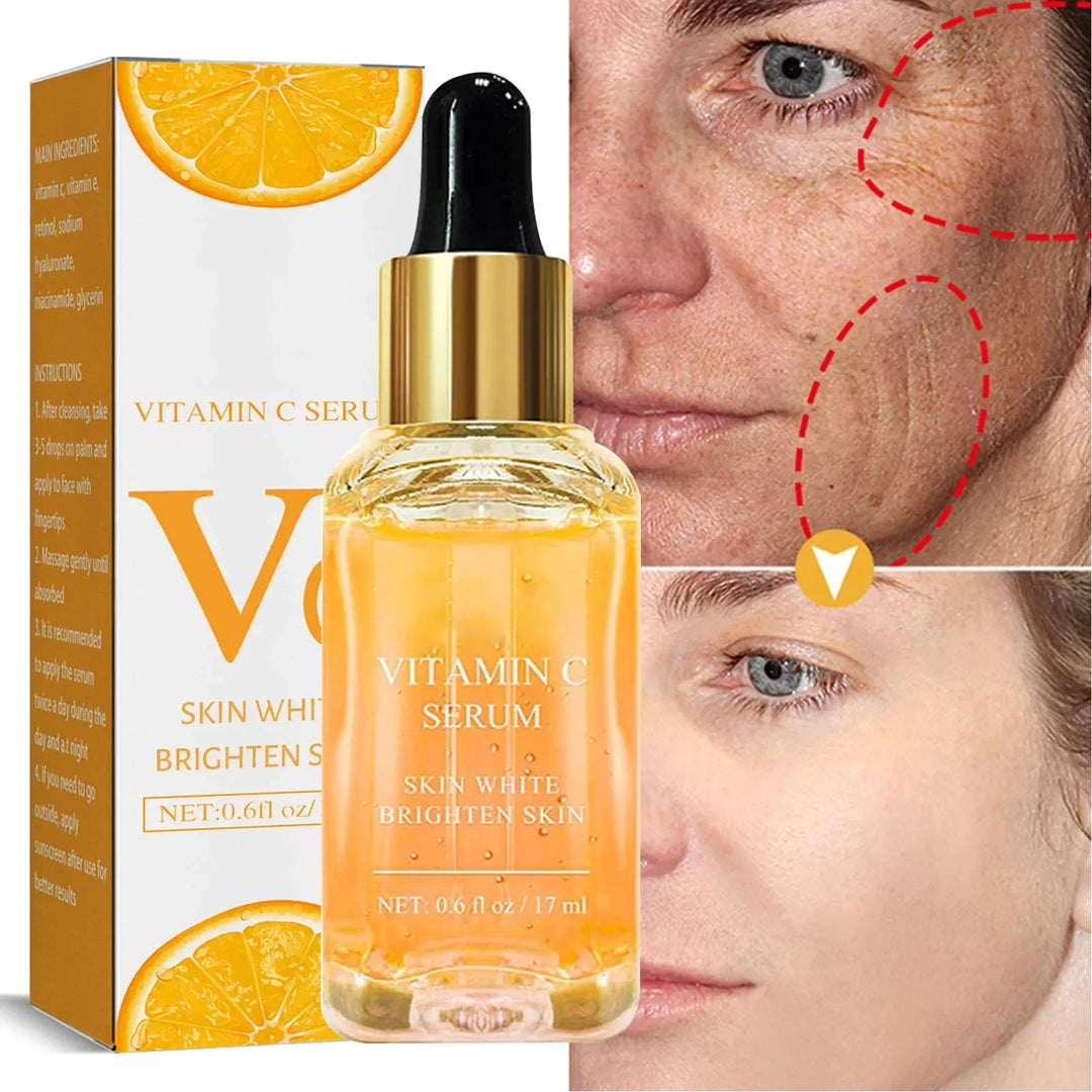 Vitamin C Fade Dark Spots Serum Whitening Freckles Fade Melanin Retinol Anti-wrinkle Essence Brightening Korean Skincare 2024