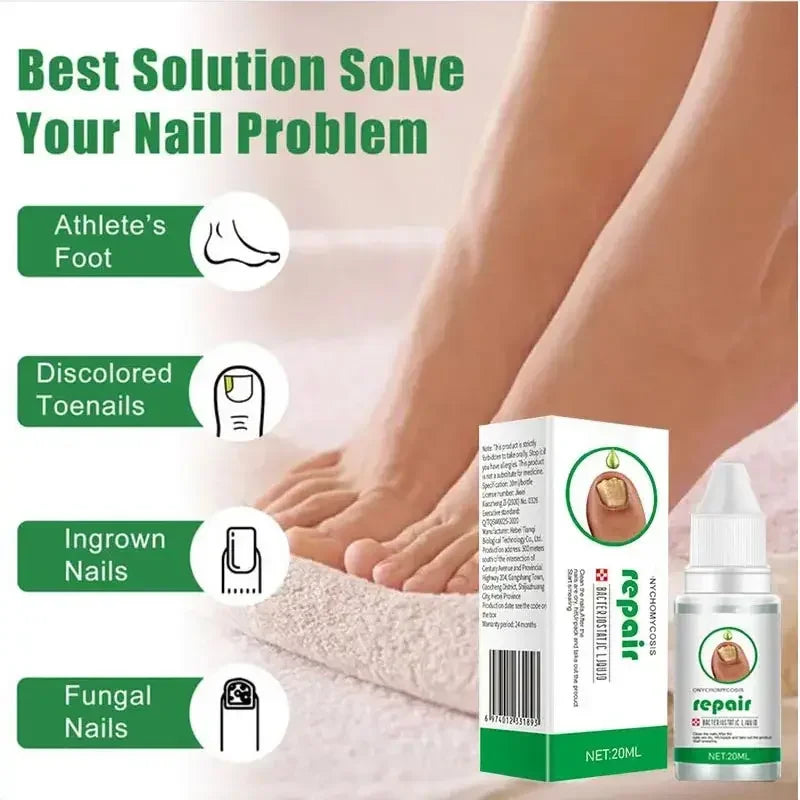 Nail Fungus Treatment Serum Toe Fungal Repair Products Hand Foot Care Removal Gel Anti Infection Onychomycosis Paronychia