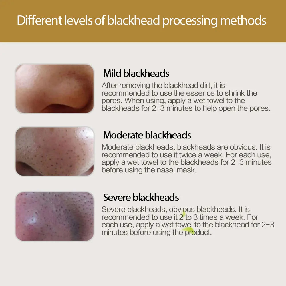 Blackhead Remover Nose Mask Mineral Mud Clean Remover Shrink Pore Black Mask Peeling Acne Deep Cleansing Skin Care Nose Mask