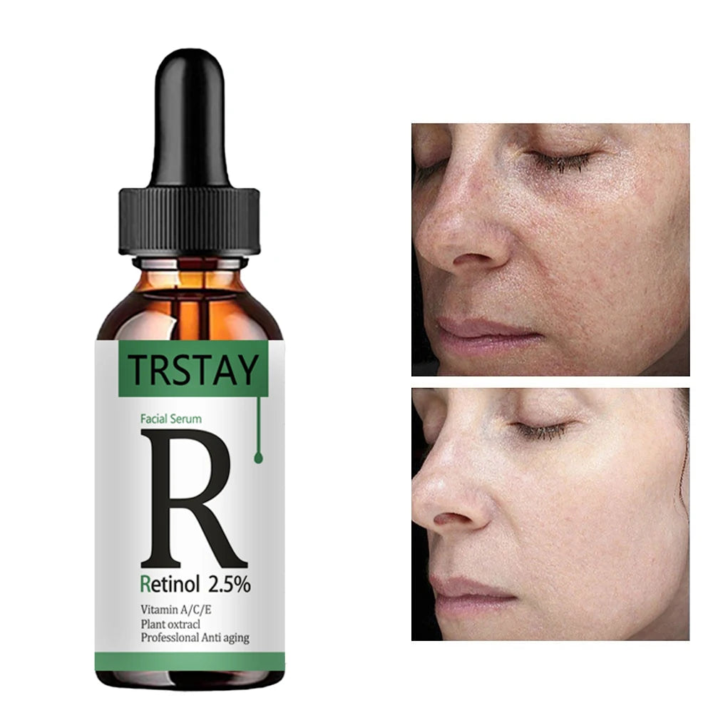 Retinol 2.5% Vitamin C / A Facial Anti Wrinkle Serum Remove Dark Spots Collagen Serum Anti Aging Essence Whitening Face Serum