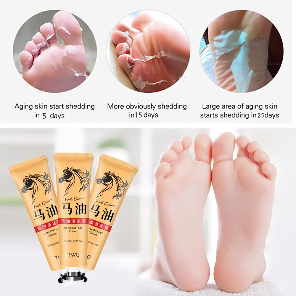 Anti Crack Hand Foot Cream Horse Oil Anti-Drying Heel Cracked Repair Hand Lotion Moisturizing Whitening Remover Dead Skin Care