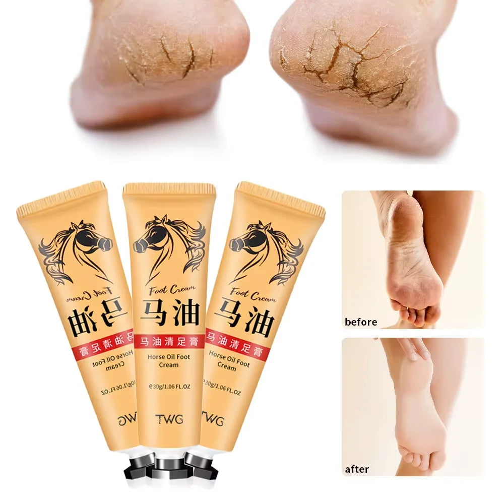 Anti Crack Hand Foot Cream Horse Oil Anti-Drying Heel Cracked Repair Hand Lotion Moisturizing Whitening Remover Dead Skin Care