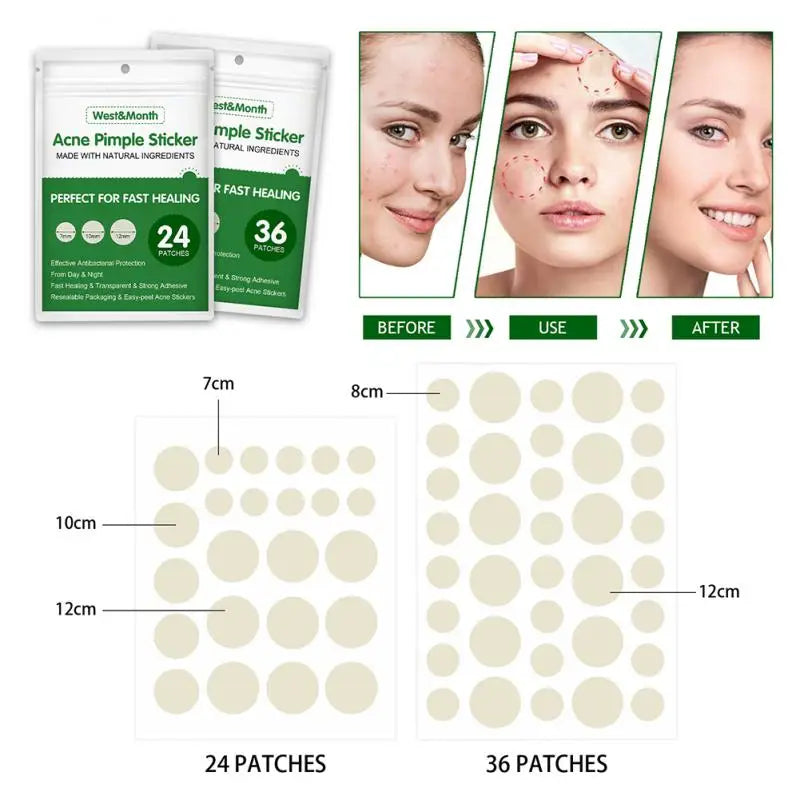 Waterproof Acne Pimple Patch Sticker Acne Treatment Pimple Remover Blemish Spot Facial Mask Skin Care Bathroom Accessories