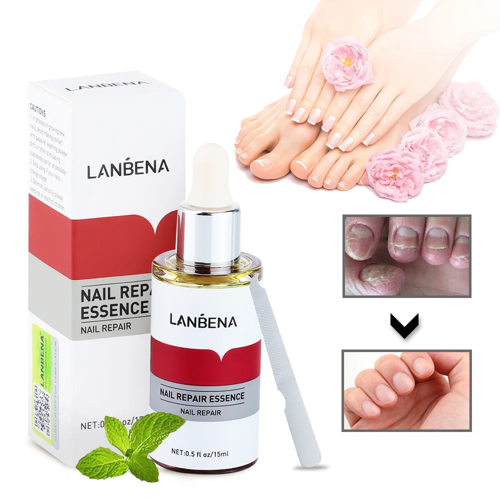 Nail Fungal Treatment Essence Oil Foot Toe Nail Fungus Removal Serum Repair Onychomycosi Anti Infection Gel Care Products