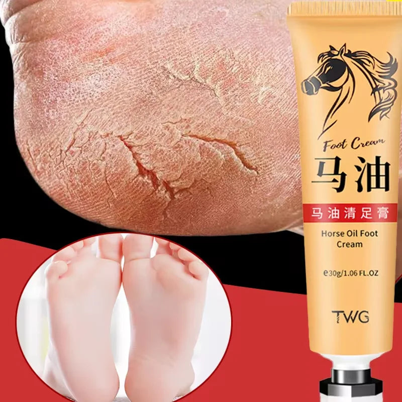 Anti Crack Hand Foot Cream Horse Oil Anti-Drying Heel Cracked Repair Hand Lotion Moisturizing Whitening Remover Dead Skin Care